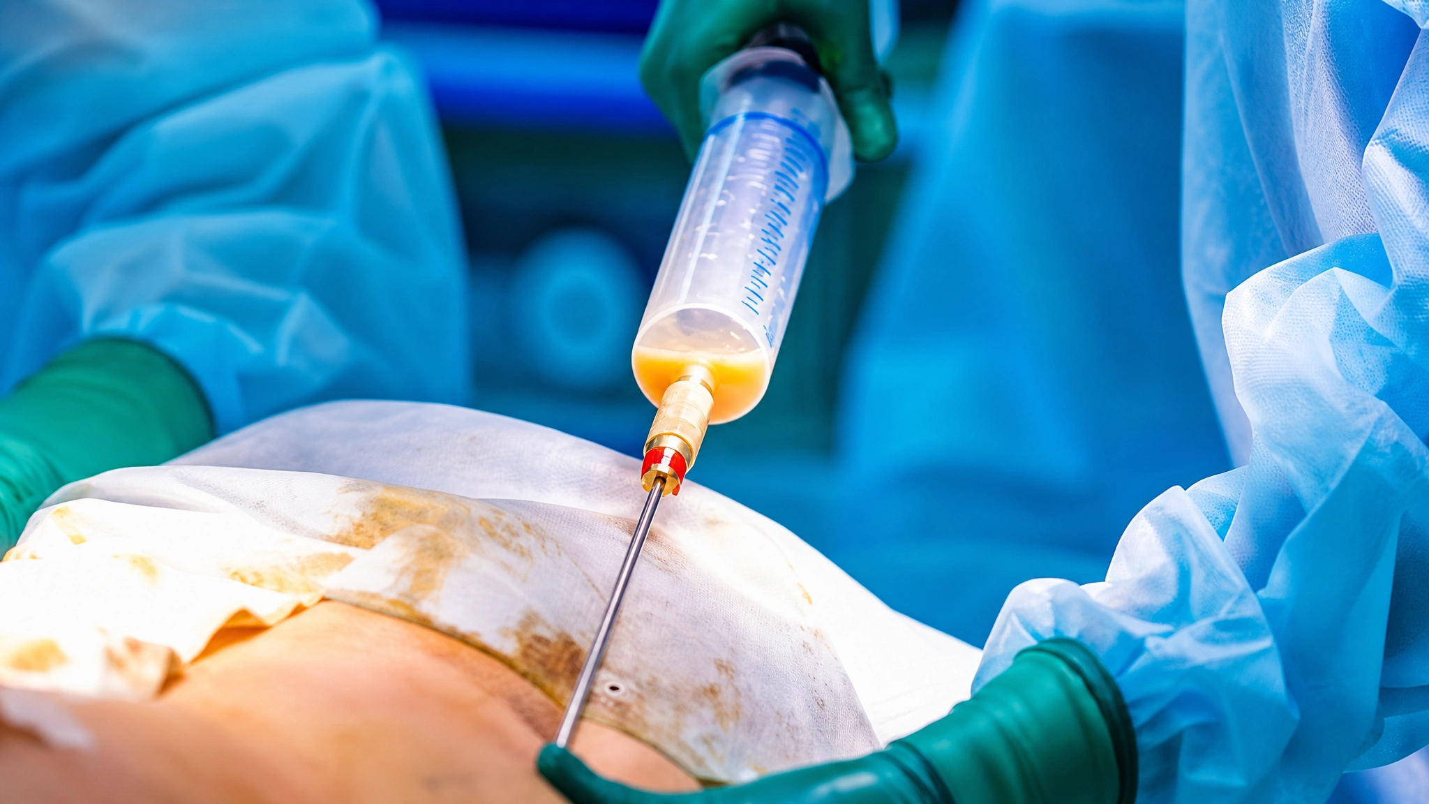 Surgical fat removal